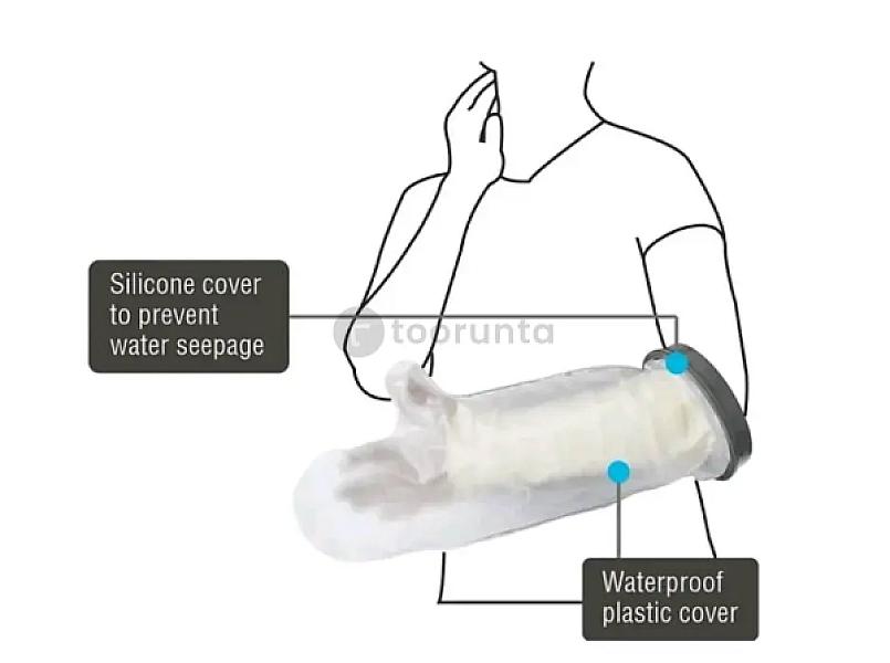 Cast Cover Arm (From Wrist To Elbow)